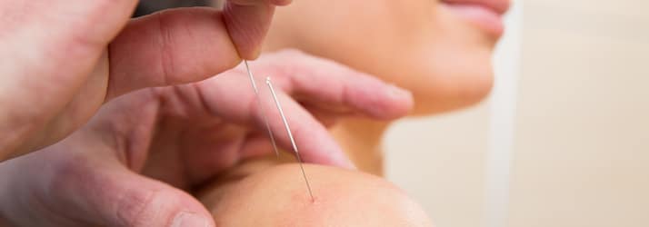 Acupuncture in Peoria IL